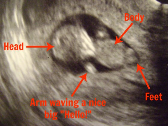 I'm Back!! - finddailyjoy.com